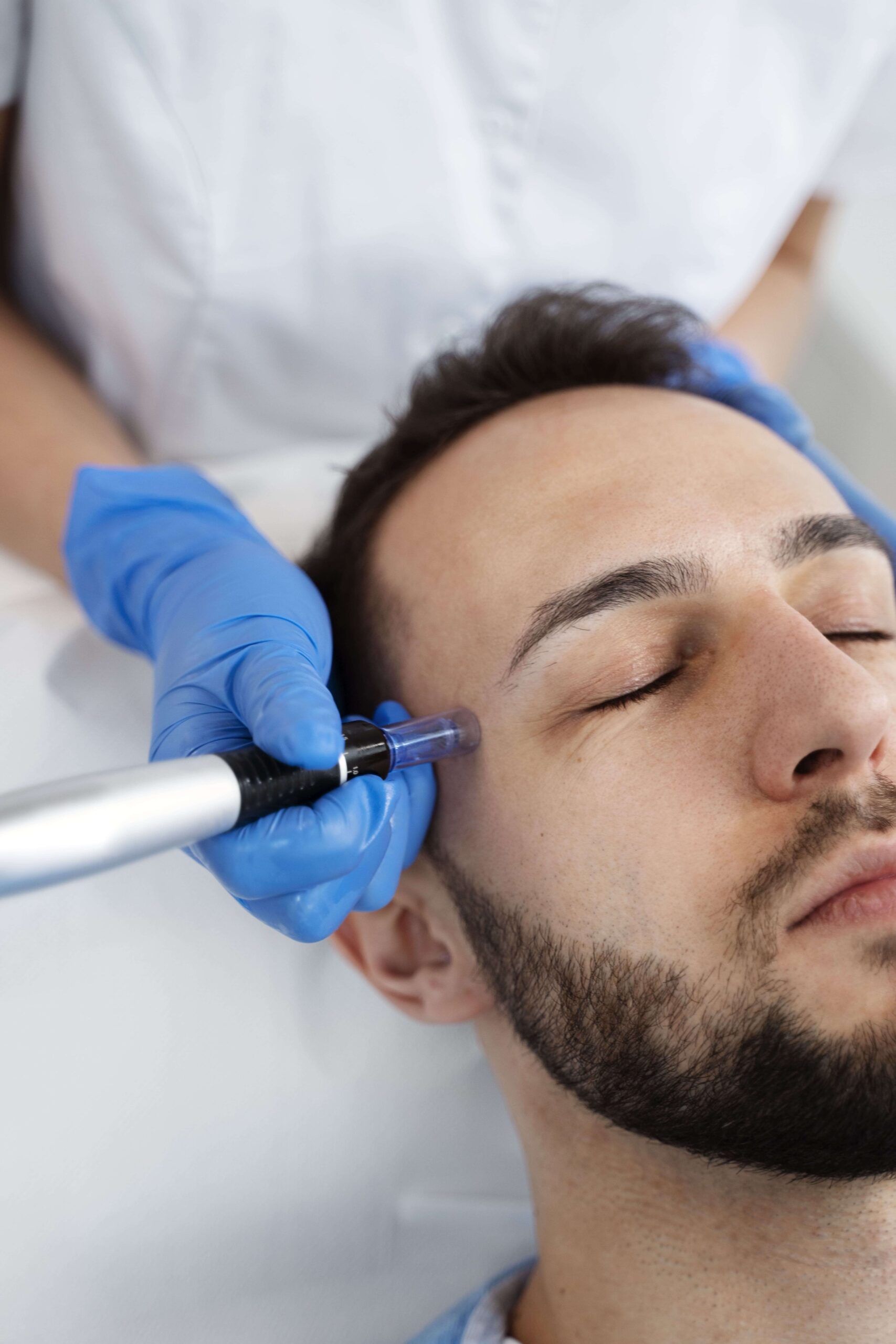 dermapen con exomas
