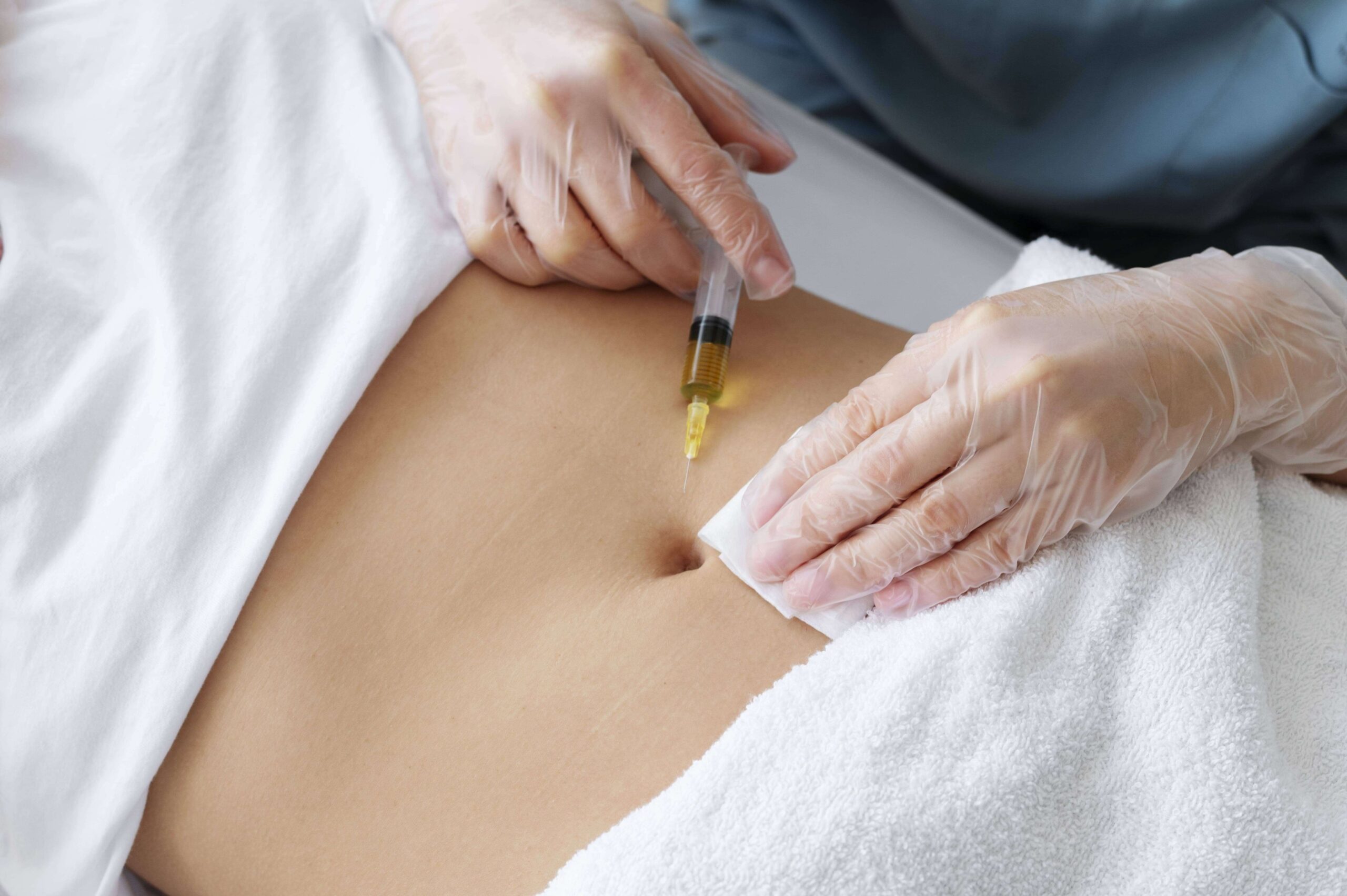 mesoterapia_corporal